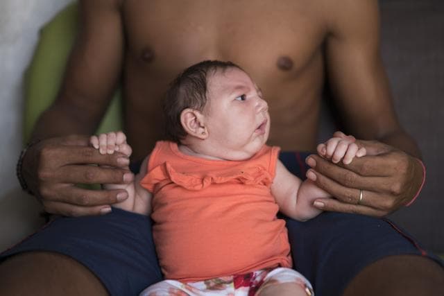 Dejailson Arruda holds his daughter Luiza at their house in Santa Cruz do Capibaribe, Pernambuco state, Brazil. (AP) Dejailson Arruda holds his daughter Luiza at their house in Santa Cruz do Capibaribe, Pernambuco state, Brazil. (AP)