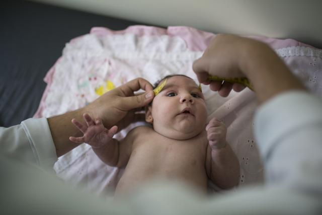 Luiza has her head measured by a neurologist at the Mestre Vitalino Hospital in Caruaru, Pernambuco state, Brazil. (AP) Luiza has her head measured by a neurologist at the Mestre Vitalino Hospital in Caruaru, Pernambuco state, Brazil. (AP)