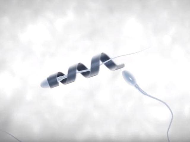 Scientists have developed motorised ‘spermbots’ by attaching tiny metal helices to sperm cells that can aid poor swimmers to reach an egg, an advance that could improve fertility treatments.(YouTube)