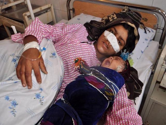 Reza Gul, 20, whose nose was sliced off by her husband, lies on a bed with her baby as she receives treatment at a hospital in the northern province of Faryab. (AFP) Reza Gul, 20, whose nose was sliced off by her husband, lies on a bed with her baby as she receives treatment at a hospital in the northern province of Faryab. (AFP)