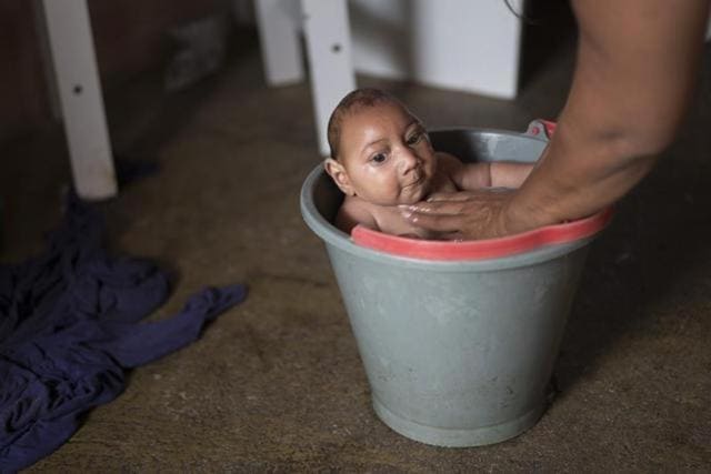 Solange Ferreira bathes her son Jose Wesley in a bucket at their house in Poco Fundo, Pernambuco state, Brazil. Ferreira says her son enjoys being in the water, she places him in the bucket several times a day to calm him. (AP Photo) Solange Ferreira bathes her son Jose Wesley in a bucket at their house in Poco Fundo, Pernambuco state, Brazil. Ferreira says her son enjoys being in the water, she places him in the bucket several times a day to calm him. (AP Photo)