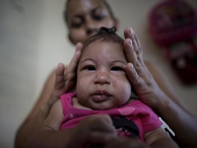 Rosana Vieira Alves fixes the hair of her 4-month-old daughter Luana Vieira, who was born with microcephaly, at their house in Olinda, Brazil. The suspected link between the Zika virus and a birth defect known as microcephaly appears "stronger and stronger". (REUTERS) Rosana Vieira Alves fixes the hair of her 4-month-old daughter Luana Vieira, who was born with microcephaly, at their house in Olinda, Brazil. The suspected link between the Zika virus and a birth defect known as microcephaly appears "stronger and stronger". (REUTERS)