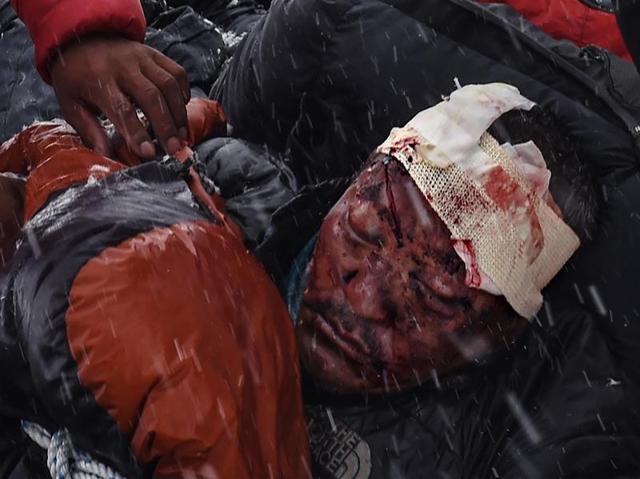 In this image released by World Press Photo titled "Avalanche, 25-27 April, Everest Base Camp, Nepal" by photograher Roberto Schmidt for AFP which won second prize Spot News stories category shows a man suffering from severe head trauma being bundled in a sleeping bag used as a makeshift stretcher while being taken by rescuers to a medical tent moments after the avalanche in Nepal, 25 April 2015. (Roberto Schmidt/AFP, World Press Photo via AP) (Roberto Schmidt/ AFP/ AP) In this image released by World Press Photo titled "Avalanche, 25-27 April, Everest Base Camp, Nepal" by photograher Roberto Schmidt for AFP which won second prize Spot News stories category shows a man suffering from severe head trauma being bundled in a sleeping bag used as a makeshift stretcher while being taken by rescuers to a medical tent moments after the avalanche in Nepal, 25 April 2015. (Roberto Schmidt/AFP, World Press Photo via AP) (Roberto Schmidt/ AFP/ AP)