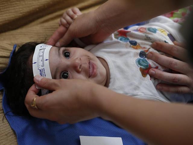 Three-month-old Esther Kamilly has her head measured by Brazilian and US health workers from the United States' Centers for Disease Control and Prevention (CDC) at her home in Joao Pessoa, Brazil. (AP) Three-month-old Esther Kamilly has her head measured by Brazilian and US health workers from the United States' Centers for Disease Control and Prevention (CDC) at her home in Joao Pessoa, Brazil. (AP)