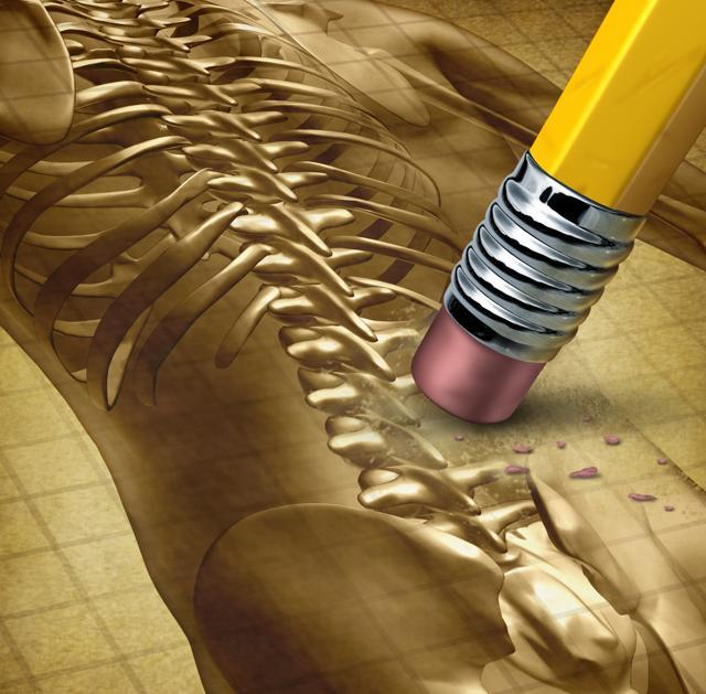 The study also found osteopathy beneficial to patients with more moderate cases of lower back pain. (Shutterstock) The study also found osteopathy beneficial to patients with more moderate cases of lower back pain. (Shutterstock)