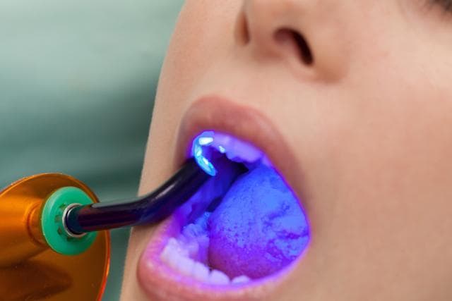 To maintain a healthy mouth, the oral environment must have a relatively neutral chemical make-up, or a neutral pH. When the environment in the mouth becomes more acidic, dental cavities or other disorders can develop. (Shutterstock) To maintain a healthy mouth, the oral environment must have a relatively neutral chemical make-up, or a neutral pH. When the environment in the mouth becomes more acidic, dental cavities or other disorders can develop. (Shutterstock)