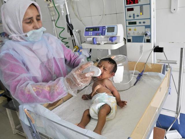 A nurse feeds a baby girl suffering from Down’s Syndrome at Srinagar’s GP Pant Hospital. (Waseem Andrabi/HT Photo) A nurse feeds a baby girl suffering from Down’s Syndrome at Srinagar’s GP Pant Hospital. (Waseem Andrabi/HT Photo)
