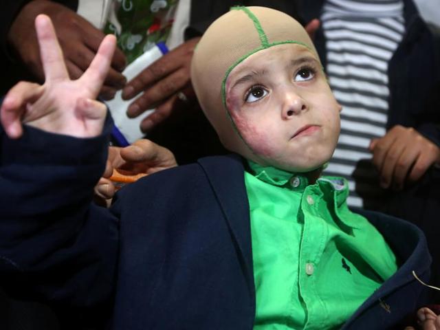 Five-year-old Ahmed Dawabsha, a Palestinian boy who survived a firebombing by Jewish extremists targeting his family home that killed his parents and brother, is surrounded by relatives and Palestinian officials during a visit in the northern West Bank city of Nablus. (AFP) Five-year-old Ahmed Dawabsha, a Palestinian boy who survived a firebombing by Jewish extremists targeting his family home that killed his parents and brother, is surrounded by relatives and Palestinian officials during a visit in the northern West Bank city of Nablus. (AFP)