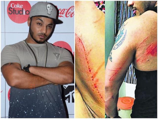 For the uninitiated, Raftaar — who has delivered hit tracks such as Singh And Kaur, Tamanche Pe Disco, Dhup Chik and Madam Ji — was performing in Gurgaon on Thursday for a crowd of more than 6,000 when fans got out of control and broke barricades to get selfies clicked with him. For the uninitiated, Raftaar — who has delivered hit tracks such as Singh And Kaur, Tamanche Pe Disco, Dhup Chik and Madam Ji — was performing in Gurgaon on Thursday for a crowd of more than 6,000 when fans got out of control and broke barricades to get selfies clicked with him.