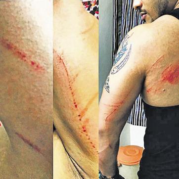 Raftaar — who was taken to a city clinic for medical aid — has nothing to complain about, and only expresses gratitude towards those who have made him successful. Raftaar — who was taken to a city clinic for medical aid — has nothing to complain about, and only expresses gratitude towards those who have made him successful.