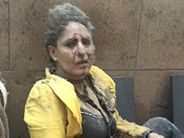 Jet Airways flight attendant, Nidhi Chaphekar’s family will soon join her in Belgium where she is recovering from her injuries sustained in the Brussels blast at the airport.(Reuters Photo) Jet Airways flight attendant, Nidhi Chaphekar’s family will soon join her in Belgium where she is recovering from her injuries sustained in the Brussels blast at the airport.(Reuters Photo)