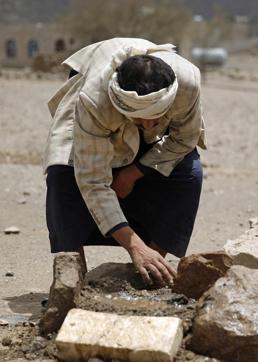 Faisal Ahmed, whose son, Udai Faisal, died of severe acute malnutrition, tends to his grave in Hazyaz village, on the southern outskirts of Sanaa, Yemen. (AP) Faisal Ahmed, whose son, Udai Faisal, died of severe acute malnutrition, tends to his grave in Hazyaz village, on the southern outskirts of Sanaa, Yemen. (AP)