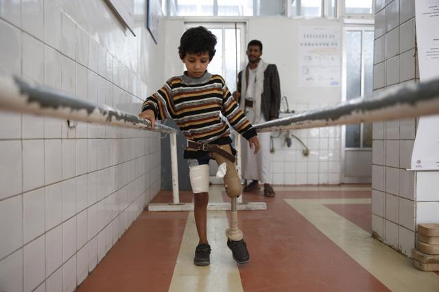 A young boy who lost his leg in the Yemen war uses a prosthetic limb at a government-run rehabilitation center in Sanaa, Yemen. (AP) A young boy who lost his leg in the Yemen war uses a prosthetic limb at a government-run rehabilitation center in Sanaa, Yemen. (AP)