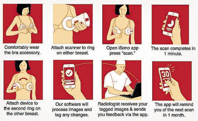 It monitors breast health to detect breast cancer early when it’s treatable