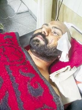 One of the victims Resham Singh Godhara (28). (Keshav Singh/HT Photo) One of the victims Resham Singh Godhara (28). (Keshav Singh/HT Photo)