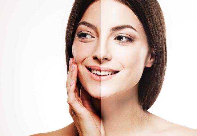 You can de-tan effectively with simple home-made face packs. (Shutterstock) You can de-tan effectively with simple home-made face packs. (Shutterstock)