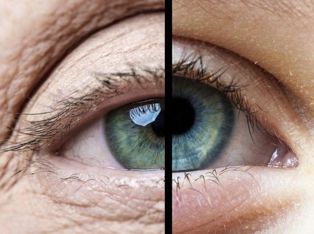 While antiretroviral therapy is enabling many people with HIV to live longer even after being infected, it often leads to premature ageing in them, doctors observe. (Shutterstock) While antiretroviral therapy is enabling many people with HIV to live longer even after being infected, it often leads to premature ageing in them, doctors observe. (Shutterstock)