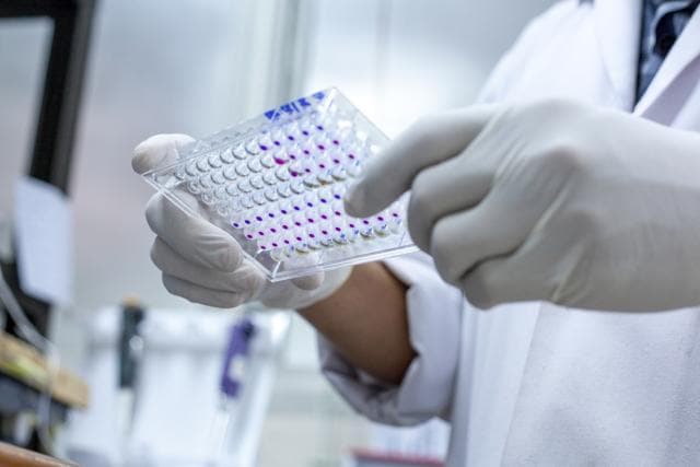 The new study has applied an accurate biomarker to measure just how much HIV infection ages people at the biological level -- an average of almost 5 years. (Shutterstock) The new study has applied an accurate biomarker to measure just how much HIV infection ages people at the biological level -- an average of almost 5 years. (Shutterstock)