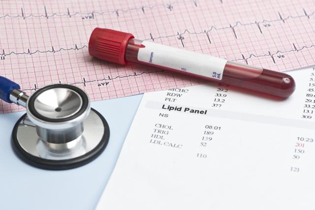 In Denmark, the use of random, non-fasting cholesterol testing at any time of the day irrespective of food intake has been used successfully since 2009. (Shutterstock) In Denmark, the use of random, non-fasting cholesterol testing at any time of the day irrespective of food intake has been used successfully since 2009. (Shutterstock)