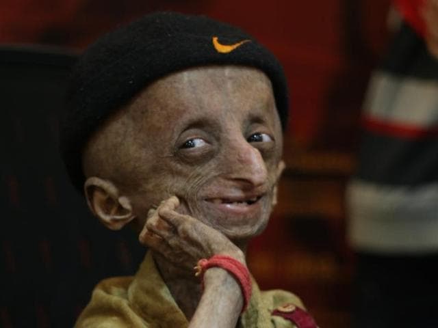 Nihal Shrinivas Bitla was campaigning to raise an awareness about his condition, a rare genetic disorder called progeria.(Bhushan Koyande/ HT file photo)