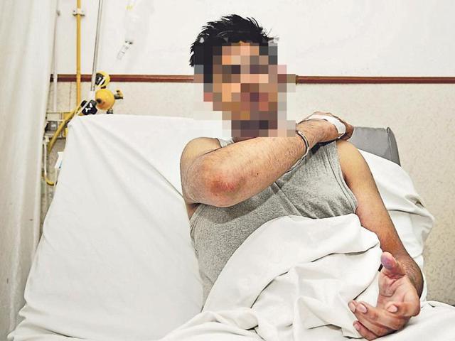 One of the injured students in hospital. Both victims were discharged after treatment.(Burhaan Kinu/HT Photo) One of the injured students in hospital. Both victims were discharged after treatment.(Burhaan Kinu/HT Photo)