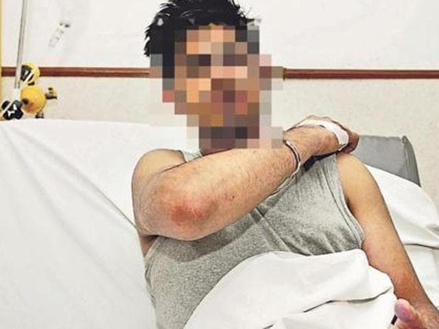 One of the injured students in hospital. Both victims were discharged after treatment. (Burhaan Kinu/HT Photo) One of the injured students in hospital. Both victims were discharged after treatment. (Burhaan Kinu/HT Photo)