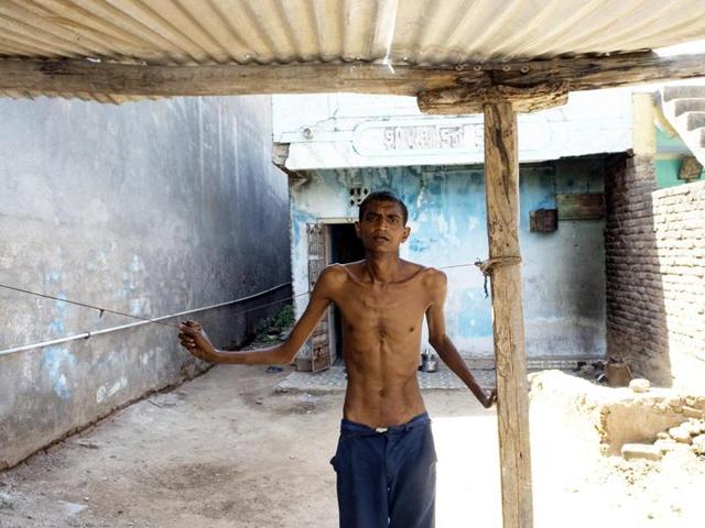 With silicosis eating away at his lungs, Mukesh Chaganbhai’s frame is wracked by coughing fits, breathlessness and fever. (Khambhat, 2009) (MINT) With silicosis eating away at his lungs, Mukesh Chaganbhai’s frame is wracked by coughing fits, breathlessness and fever. (Khambhat, 2009) (MINT)