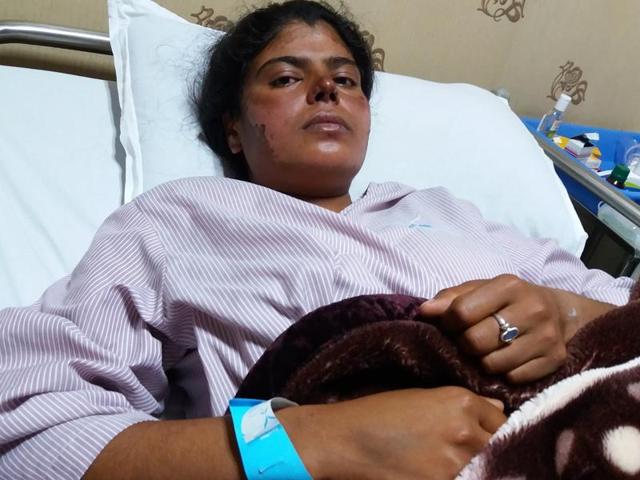 Seema Goswami from Haryana, who reached Everest summit on May 20, recovering at Norvik Hospital in Kathmandu. (Utpal Parashar/ HT Photo) Seema Goswami from Haryana, who reached Everest summit on May 20, recovering at Norvik Hospital in Kathmandu. (Utpal Parashar/ HT Photo)