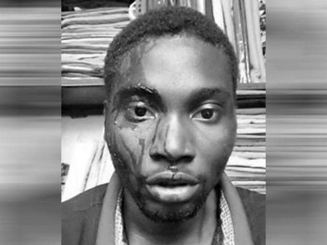 Nigerian national Ghazeem, third-year degree student in a city college, was attacked in Banjara hills in Hyderabad. (Facebook/Nigerians Association-Ts) Nigerian national Ghazeem, third-year degree student in a city college, was attacked in Banjara hills in Hyderabad. (Facebook/Nigerians Association-Ts)