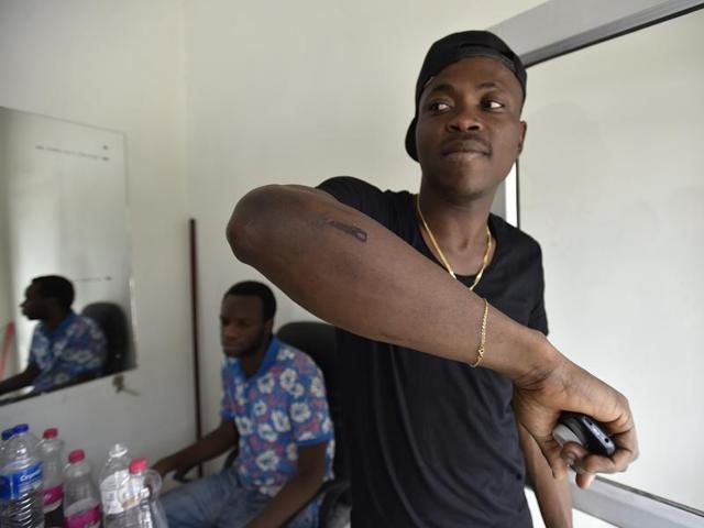 Kenneth shows the injuries that he sustained in a attack on Thursday.(Virendra Singh Gosain/HT Photo)