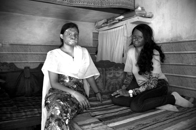 The Stop Acid Attacks campaign has launched an appeal that requests people to donate, so that air conditioners and other equipments to deal with the heat can be bought for the acid attack survivors.(Facebook/Stop Acid Attacks) The Stop Acid Attacks campaign has launched an appeal that requests people to donate, so that air conditioners and other equipments to deal with the heat can be bought for the acid attack survivors.(Facebook/Stop Acid Attacks)