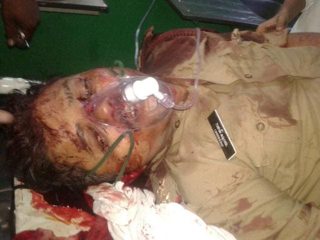 Farah Police Station SHO Santosh Yadav, who died in clashes with protesters, believed to be of Azad Bharat Vidhik Vaicharik Kranti Satyagrahi, at a hospital in Mathura on June 02, 2016. (Anil Aggarwal/ Hindustan Times)