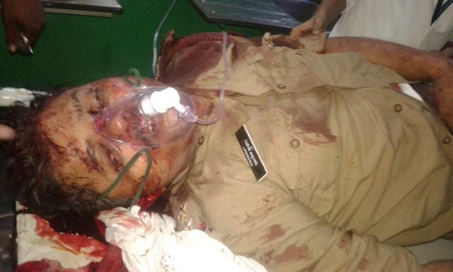 Two bullets hit Station Officer (Farah), Santosh Yadav, who was declared dead on arrival by doctors at Niyati Hospital. (Anant Ram/HT Photo) Two bullets hit Station Officer (Farah), Santosh Yadav, who was declared dead on arrival by doctors at Niyati Hospital. (Anant Ram/HT Photo)