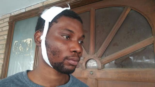 Damilola Kazeem after he was injured in an alleged assault Damilola Kazeem after he was injured in an alleged assault