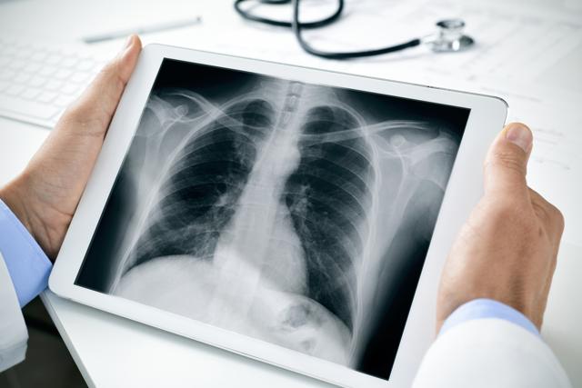 Hazardous gases asphyxiate by displacing oxygen in the air, leading to breathlessness, dizziness, headaches, nausea and vomiting. (Shutterstock) Hazardous gases asphyxiate by displacing oxygen in the air, leading to breathlessness, dizziness, headaches, nausea and vomiting. (Shutterstock)