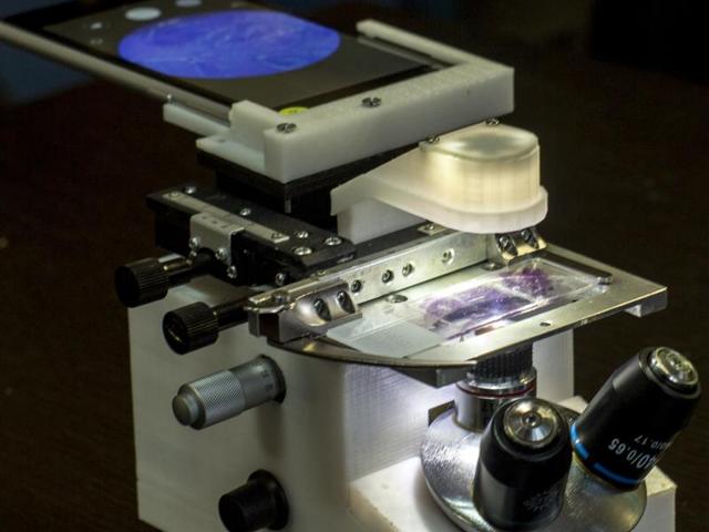 The microscope is smaller than the conventional ones used in labs (HT Photo) The microscope is smaller than the conventional ones used in labs (HT Photo)