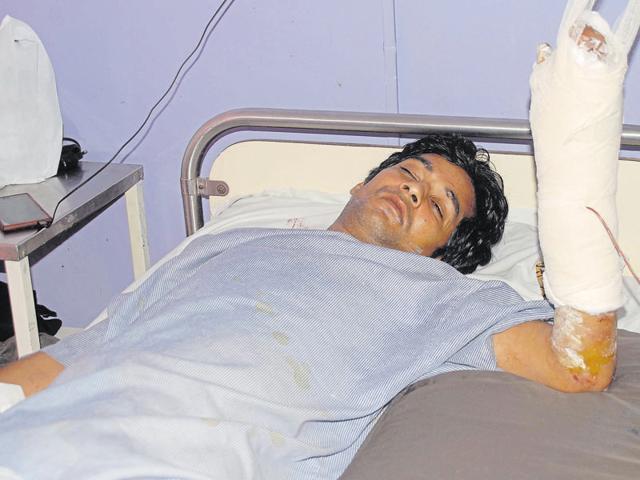 While the robbers managed to flee, car driver Kailash Sharma, who was shot in the left hand, was rushed to hospital. (Ishwar Chand/HT Photo) While the robbers managed to flee, car driver Kailash Sharma, who was shot in the left hand, was rushed to hospital. (Ishwar Chand/HT Photo)