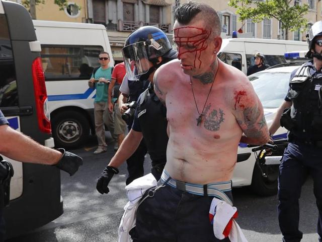 Police detain an injured supporter near port of Marseille before the game. (Reuters Photo) Police detain an injured supporter near port of Marseille before the game. (Reuters Photo)