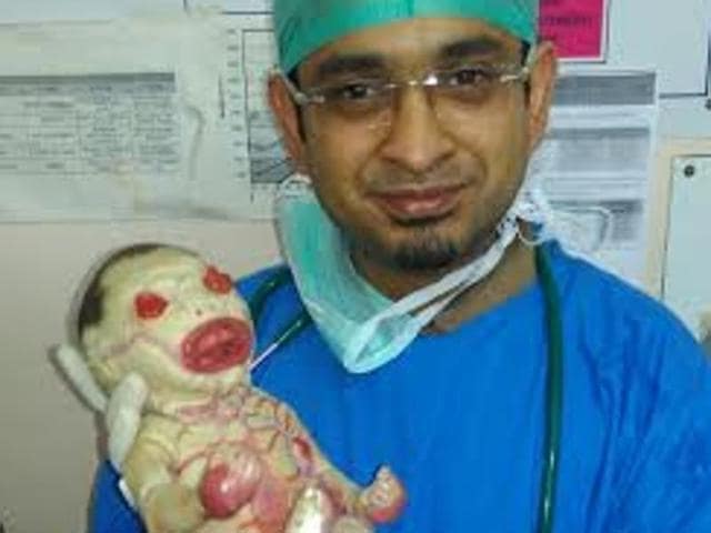 Nagpur Harlequin Baby Dies Two Days After Birth Latest News India Hindustan Times