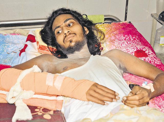 Victim Gurpartap Singh undergoing treatment at Guru Nanak Dev Hospital in Amritsar.(Sameer Sehgal/HT Photo) Victim Gurpartap Singh undergoing treatment at Guru Nanak Dev Hospital in Amritsar.(Sameer Sehgal/HT Photo)