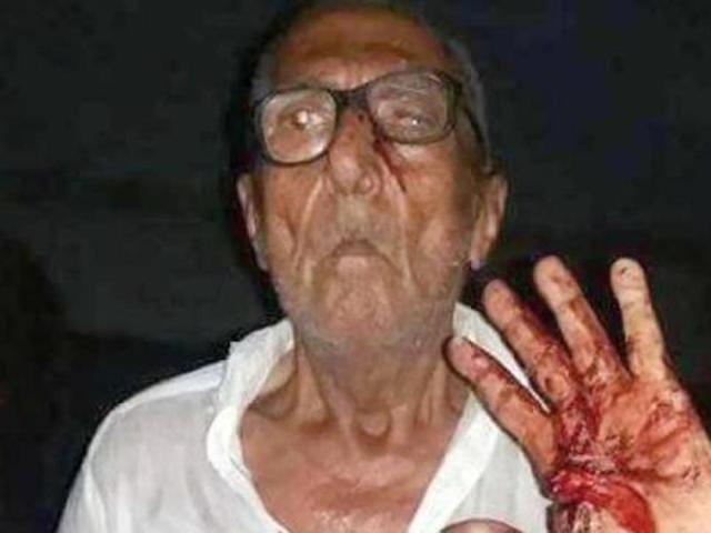 Gokal Das was allegedly badly beaten up by constable Ali Hussain in the remote village of Hayat Pitafi in Ghotki district of the southern Sindh province. (Photo courtesy- Twitter) Gokal Das was allegedly badly beaten up by constable Ali Hussain in the remote village of Hayat Pitafi in Ghotki district of the southern Sindh province. (Photo courtesy- Twitter)
