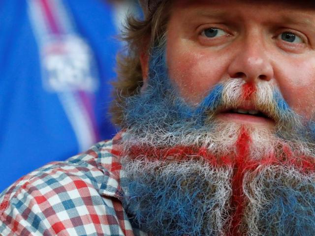 An Iceland fan supporting a very patriotically dyed beard. (REUTERS PHOTO)