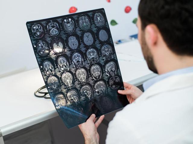 Brain tumour needs fats to multiply, claims a new research.(Shutterstock)