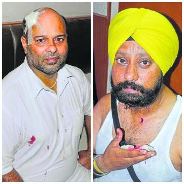 The injured, Pawan Kumar and Lakhbir Singh. (HT Photo)