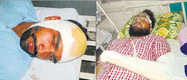 Dalit youths who were injured in the fight at Achal village near Nabha on Saturday. (HT Photos) Dalit youths who were injured in the fight at Achal village near Nabha on Saturday. (HT Photos)