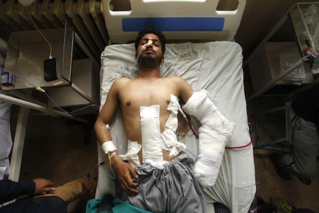 A man with pellet injuries at Shri Maharaja Hari Singh hospital in Srinagar. (Waseem Andrabi /HT Photo) A man with pellet injuries at Shri Maharaja Hari Singh hospital in Srinagar. (Waseem Andrabi /HT Photo)