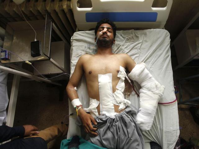A protester injured by bullets at Shri Maharaja Hari Singh hospital in Srinagar on Tuesday.(Waseem Andrabi/ HT Photo) A protester injured by bullets at Shri Maharaja Hari Singh hospital in Srinagar on Tuesday.(Waseem Andrabi/ HT Photo)