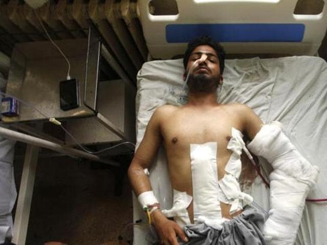 A youth hit by bullets at Shri Maharaja Hari Singh hospital in Srinagar on Tuesday. (Waseem Andrabi/HT Photo) A youth hit by bullets at Shri Maharaja Hari Singh hospital in Srinagar on Tuesday. (Waseem Andrabi/HT Photo)