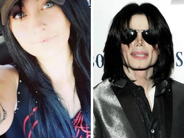 Michael Jackson explained his skin disorder after claims he was bleaching  it to become white