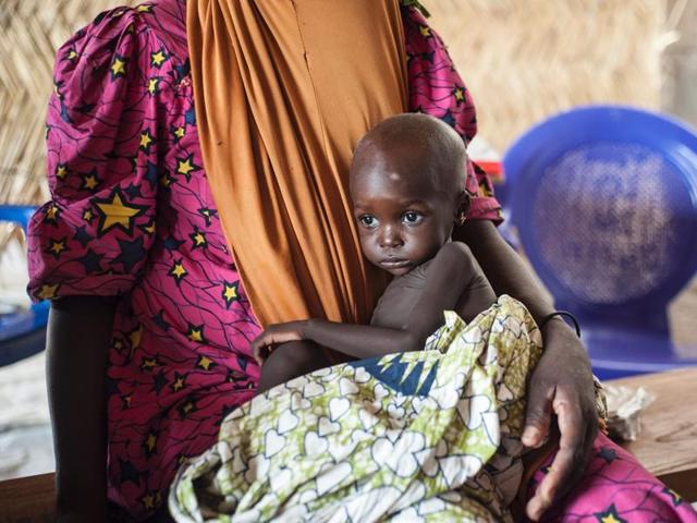 This photo taken on June 30, 2016 shows a young boy suffering from severe acute malnutrition lying on the ground at one of the Unicef nutrition clinics, in the Muna informal settlement, which houses nearly 16,000 IDPs (internally displaced people) in the outskirts of Maiduguri capital of Borno State, northeastern Nigeria. (AFP file photo) This photo taken on June 30, 2016 shows a young boy suffering from severe acute malnutrition lying on the ground at one of the Unicef nutrition clinics, in the Muna informal settlement, which houses nearly 16,000 IDPs (internally displaced people) in the outskirts of Maiduguri capital of Borno State, northeastern Nigeria. (AFP file photo)